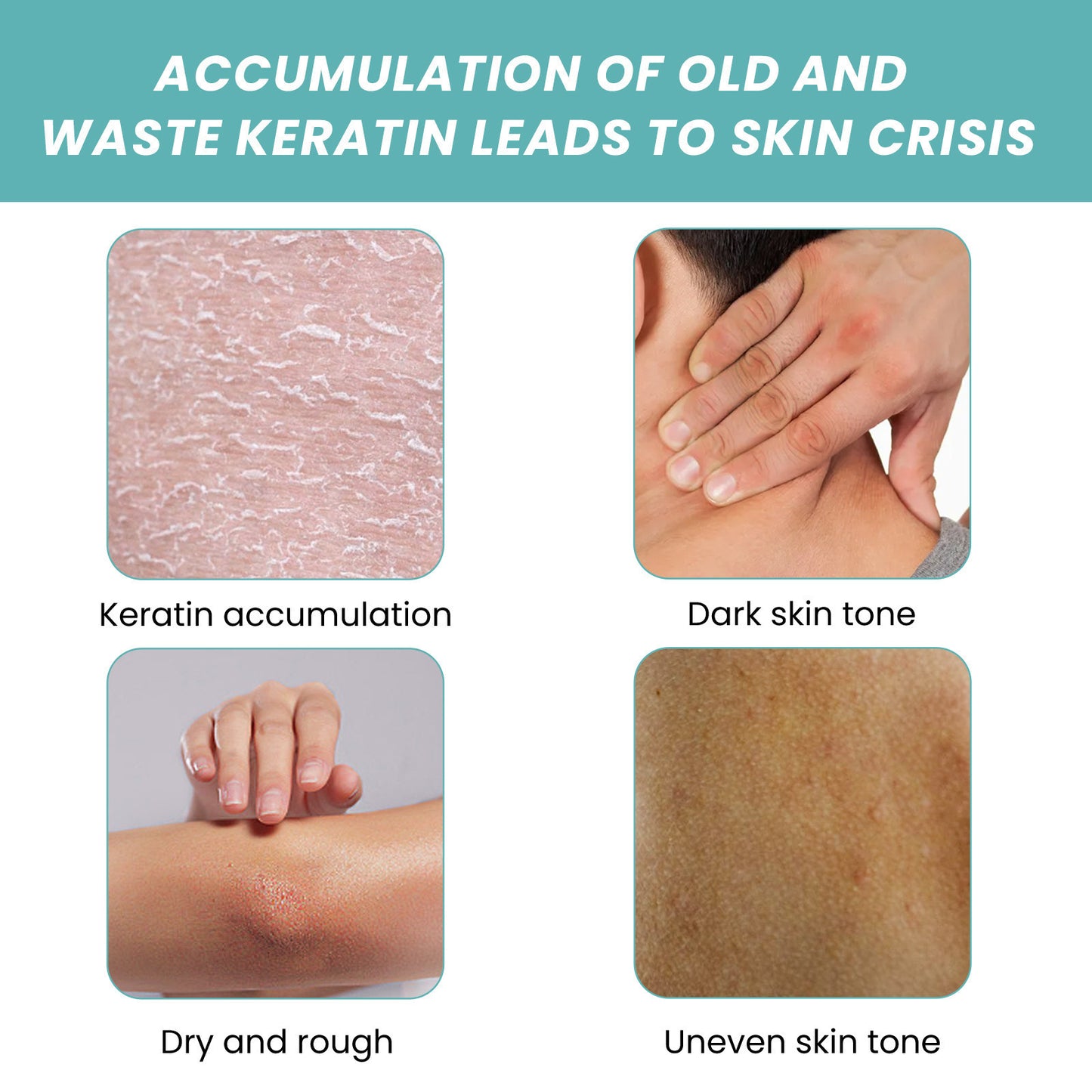 ✨ Skin So Soft Original Bath Oil – Smoothes & Softens Dry Skin 💖